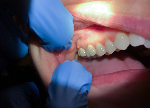 Best Emergency Dental Services for Seniors in Broadway, NC